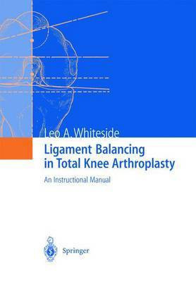 Ligament Balancing in Total Knee Arthroplasty(English, Hardcover, unknown)