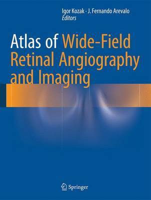 Atlas of Wide-Field Retinal Angiography and Imaging(English, Hardcover, unknown)