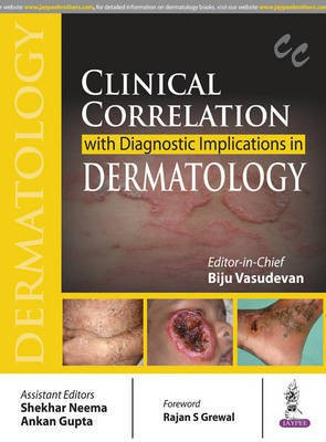 Clinical Correlation with Diagnostic Implications in Dermatology(English, Paperback, Vasudevan Biju)