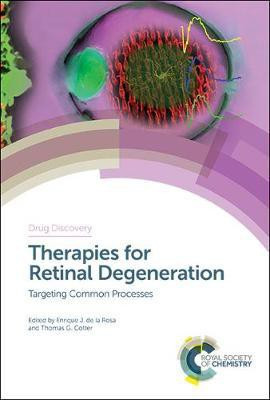 Therapies for Retinal Degeneration(English, Electronic book text, unknown)