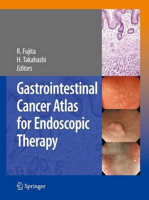 Gastrointestinal Cancer Atlas for Endoscopic Therapy(English, Electronic book text, Fujita Rikiya)