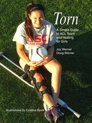 Torn(English, Electronic book text, Werner Joy)