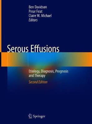 Serous Effusions(English, Hardcover, unknown)