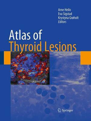 Atlas of Thyroid Lesions(English, Paperback, unknown)