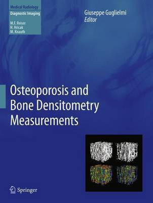 Osteoporosis and Bone Densitometry Measurements(English, Hardcover, unknown)