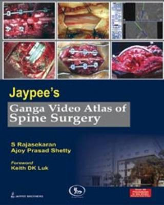 Jaypee's Ganga Video Atlas of Spine Surgery(English, Mixed media product, Rajasekaran S)