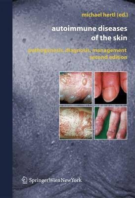 Autoimmune Diseases of the Skin(English, Hardcover, unknown)