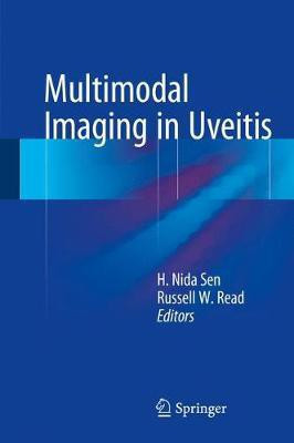 Multimodal Imaging in Uveitis(English, Hardcover, unknown)
