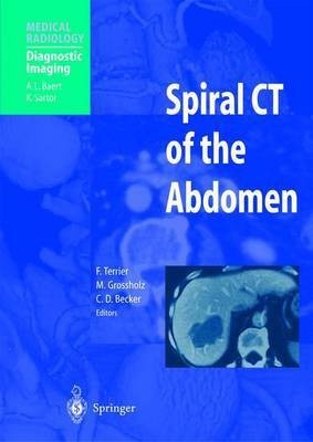 Spiral CT of the Abdomen(English, Paperback, unknown)