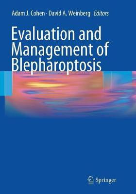Evaluation and Management of Blepharoptosis(English, Paperback, unknown)