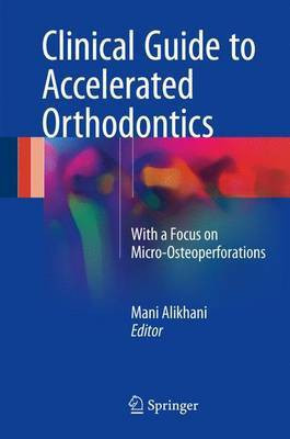 Clinical Guide to Accelerated Orthodontics(English, Hardcover, unknown)