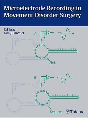 Microelectrode Recording in Movement Disorder Surgery(English, Electronic book text, unknown)