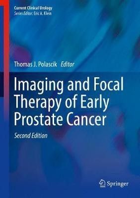 Imaging and Focal Therapy of Early Prostate Cancer(English, Hardcover, unknown)