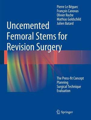Uncemented Femoral Stems for Revision Surgery; The Press-Fit Concept - Planning - Surgical Technique - Evaluation(English, Electronic book text, unknown)