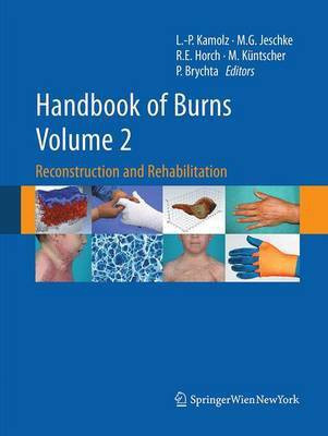 Handbook of Burns Volume 2(English, Paperback, unknown)