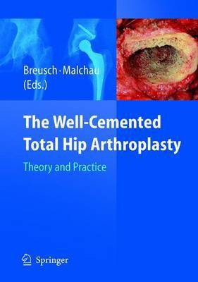 The Well-Cemented Total Hip Arthroplasty(English, Electronic book text, unknown)