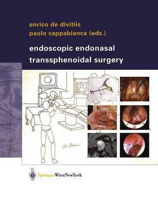 Endoscopic Endonasal Transsphenoidal Surgery(English, Paperback, unknown)