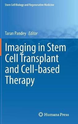 Imaging in Stem Cell Transplant and Cell-based Therapy(English, Hardcover, unknown)