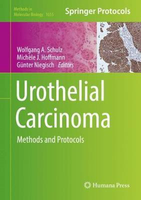 Urothelial Carcinoma(English, Hardcover, unknown)