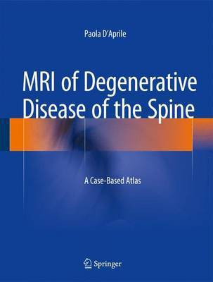 MRI of Degenerative Disease of the Spine; A Case-Based Atlas(English, Electronic book text, unknown)