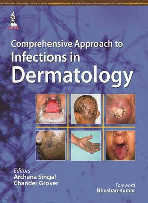 Comprehensive Approach to Infections in Dermatology(English, Hardcover, Singal Archana)