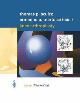 Knee Arthroplasty(English, Paperback, unknown)