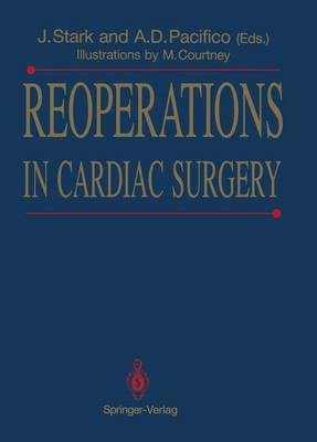 Reoperations in Cardiac Surgery(English, Paperback, unknown)