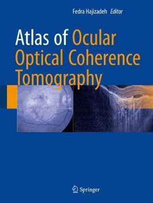 Atlas of Ocular Optical Coherence Tomography(English, Hardcover, unknown)
