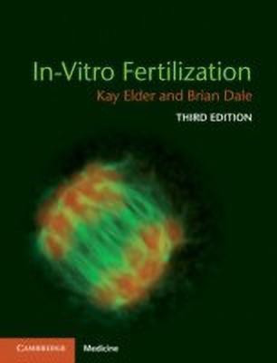 In-Vitro Fertilization(English, Paperback, Elder Kay)