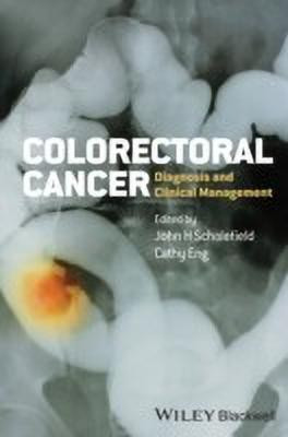 Colorectal Cancer(English, Hardcover, unknown)