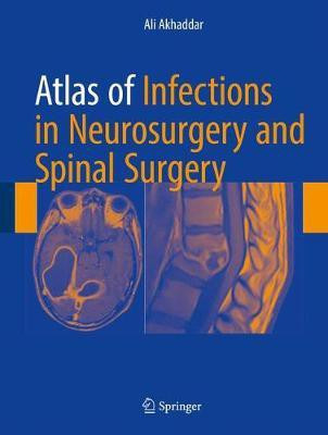 Atlas of Infections in Neurosurgery and Spinal Surgery(English, Hardcover, Akhaddar Ali)