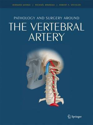 Pathology and surgery around the vertebral artery(English, Hardcover, unknown)
