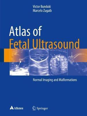 Atlas of Fetal Ultrasound(English, Hardcover, Bunduki Victor)