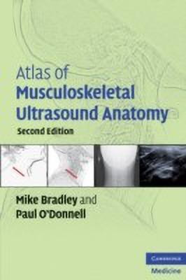 Atlas of Musculoskeletal Ultrasound Anatomy(English, Paperback, Bradley Mike)