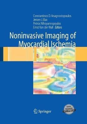 Noninvasive Imaging of Myocardial Ischemia(English, Paperback, unknown)