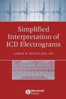 Simplified Interpretation of ICD Electrograms(English, Paperback, Hesselson Aaron B.)