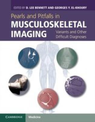 Pearls and Pitfalls in Musculoskeletal Imaging(English, Hardcover, unknown)