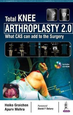 Total Knee Arthroplasty 2.0(English, Hardcover, Graichen Heiko)