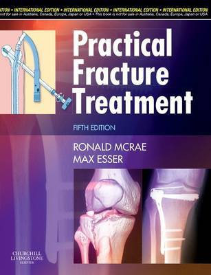 Practical Fracture Treatment, International Edition(English, Paperback, McRae Ronald)