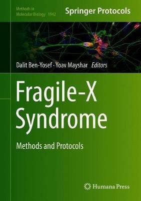 Fragile-X Syndrome(English, Hardcover, unknown)