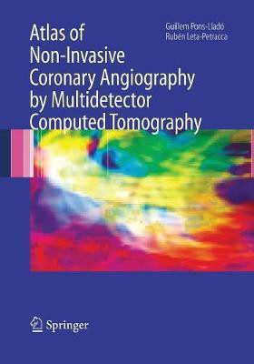 Atlas of Non-Invasive Coronary Angiography by Multidetector Computed Tomography(English, Paperback, unknown)
