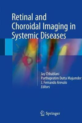 Retinal and Choroidal Imaging in Systemic Diseases(English, Hardcover, unknown)