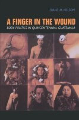 A Finger in the Wound(English, Paperback, Nelson Diane M.)