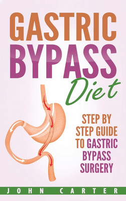 Gastric Bypass Diet(English, Hardcover, Carter John)
