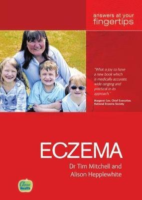 Eczema AYF(English, Paperback, Mitchell Tim)