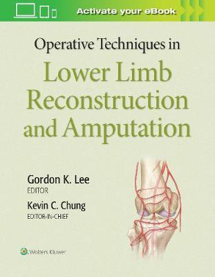 Operative Techniques in Lower Limb Reconstruction and Amputation(English, Hardcover, unknown)