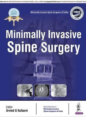 Minimally Invasive Spine Surgery(English, Hardcover, Kulkarni Arvind)