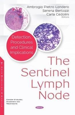 The Sentinel Lymph Node(English, Hardcover, unknown)