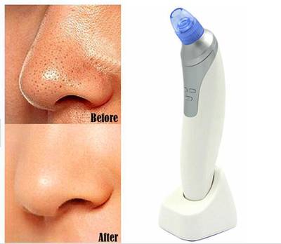 Melodeum Plastic Blackhead Remover Vacuum Suction Device  (Pack of 4)