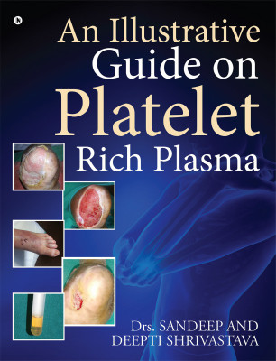 An Illustrative Guide on Platelet Rich Plasma(English, Paperback, Shrivastava Deepti)